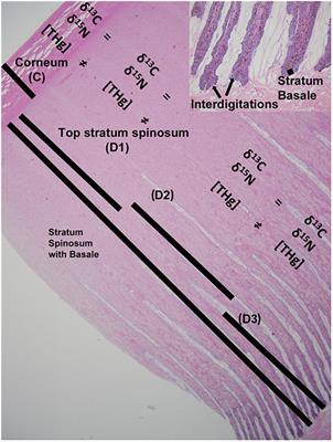 Assessing δ13C, δ15N and Total Mercury Measures in Epidermal Biopsies From Gray Whales